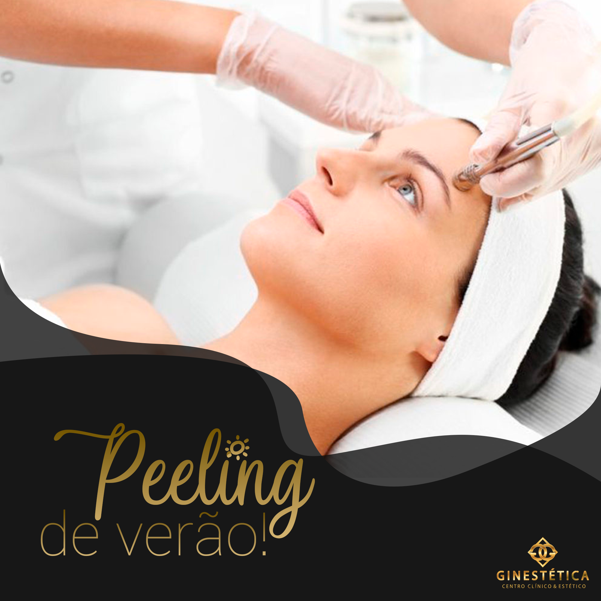 Você está visualizando atualmente PEELING NO VERÃO, PODE? SIM!